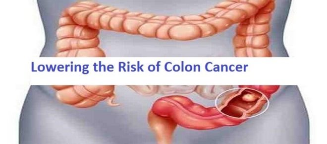 Lowering the Risk of Colon Cancer - The Cure International